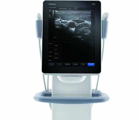 Ultrasound Mindray TE7