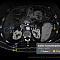 Phantom Multi-Energy CT